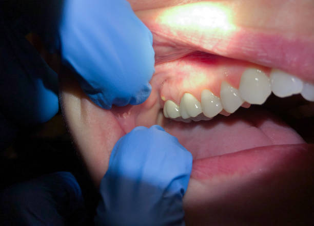 Best Pediatric Emergency Dentist in Friendship Heights Village, MD